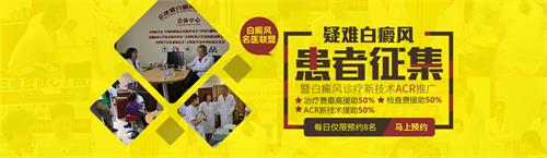 疑難白癜風患者征集項目
