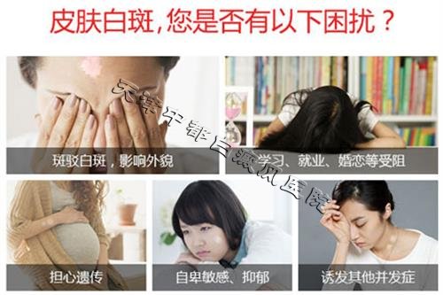 白癜風(fēng)危害