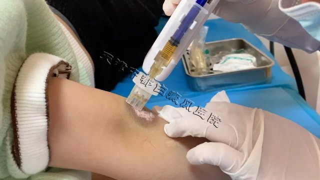 天津白癜風醫院